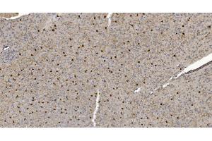 IHC analysis of Alpha B Crystallin/CRYAB using anti-Alpha B Crystallin/CRYAB antibody (ABIN7601209).