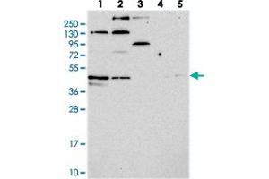Western blot analysis of Lane 1: RT-4, Lane 2: U-251 MG, Lane 3: Human Plasma, Lane 4: Liver, Lane 5: Tonsil with C14orf80 polyclonal antibody  at 1:250-1:500 dilution. (C14ORF80 抗体)