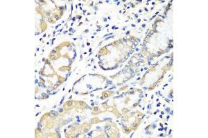 Immunohistochemistry of paraffin-embedded human stomach using EZR antibody (ABIN5974701) at dilution of 1/100 (40x lens). (Ezrin 抗体)