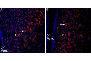 Immunohistochemistry (IHC) image for anti-Growth Hormone Secretagogue Receptor (GHSR) (AA 197-207), (Extracellular) antibody (ABIN7043264)