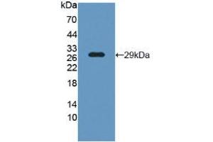 Figure. (LCP1 抗体  (AA 5-233))