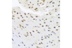 Immunohistochemistry of paraffin-embedded mouse brain using HDAC4 antibody. (HDAC4 抗体)