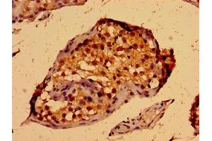 Immunohistochemistry of paraffin-embedded human testis tissue using ABIN7166440 at dilution of 1:100 (PORCN 抗体  (AA 269-332))