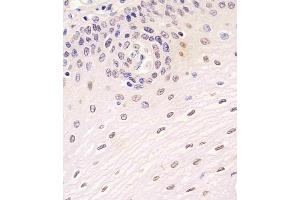A staining SIRT7 in human esophagus tissue sections by Immunohistochemistry (IHC-P - paraformaldehyde-fixed, paraffin-embedded sections). (SIRT7 抗体  (C-Term))
