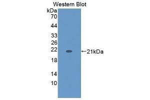 Western Blotting (WB) image for anti-Keratin 9 (KRT9) (AA 315-456) antibody (ABIN1864977) (KRT9 抗体  (AA 315-456))