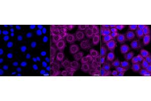 Immunocytochemical staining of HT- cells with PSMA2 antibody (ABIN7800960), 1:1,000). (Recombinant Proteasome 20S Subunit alpha 2 抗体)