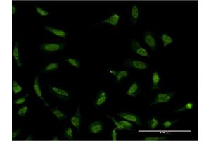 Immunofluorescence of monoclonal antibody to SFPQ on HeLa cell. (SFPQ 抗体  (AA 269-361))
