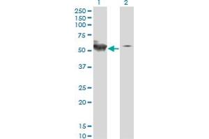 Western Blot analysis of STK38 expression in transfected 293T cell line by STK38 monoclonal antibody (M01), clone 2G8-1F3.