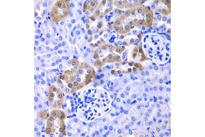 Immunohistochemistry (Paraffin-embedded Sections) (IHC (p)) image for anti-Lysosomal-Associated Membrane Protein 1 (LAMP1) (AA 80-280) antibody (ABIN3016286)