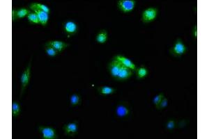 Immunofluorescence staining of HepG2 cells with ABIN7127382 at 1:60, counter-stained with DAPI. (Recombinant Caspase 9 抗体)
