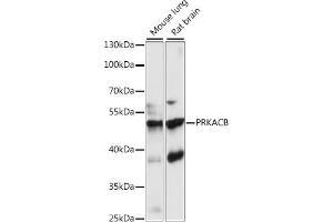 Western blot analysis of extracts of various cell lines, using PRKACB antibody (ABIN7269658) at 1:1000 dilution.