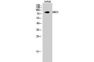 Western Blotting (WB) image for anti-MYST Histone Acetyltransferase 2 (MYST2) (Internal Region) antibody (ABIN3184974) (MYST2 抗体  (Internal Region))