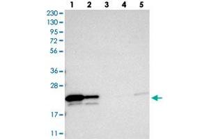 Western blot analysis of Lane 1: RT-4, Lane 2: U-251 MG, Lane 3: Human Plasma, Lane 4: Liver, Lane 5: Tonsil with GGCT polyclonal antibody . (GGCT 抗体)