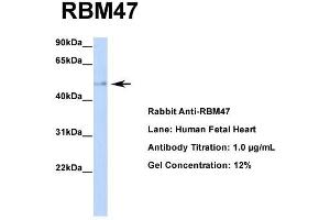 Host: Rabbit  Target Name: RBM47  Sample Tissue: Human Fetal Heart  Antibody Dilution: 1. (RBM47 抗体  (Middle Region))