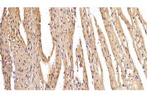 Immunohistochemistry (IHC) image for anti-Myosin Heavy Chain 2, Skeletal Muscle, Adult (MYH2) (AA 1238-1472) antibody (ABIN7432538)