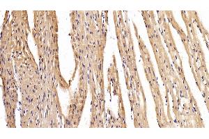 Detection of MYH2 in Mouse Cardiac Muscle Tissue using Polyclonal Antibody to Myosin Heavy Chain 2 (MYH2) (MYH2 抗体  (AA 1238-1472))