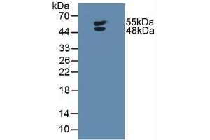 Figure. (LTBR 抗体  (AA 66-215))