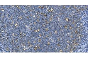 IHC analysis of Carbonic Anhydrase I/CA1 using anti-Carbonic Anhydrase I/CA1 antibody (ABIN7602620). (CA1 抗体  (AA 9-261))