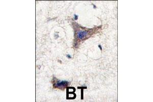 Formalin-fixed and paraffin-embedded human brain tissue reacted with SPRED1 polyclonal antibody  , which was peroxidase-conjugated to the secondary antibody, followed by DAB staining. (SPRED1 抗体  (C-Term))