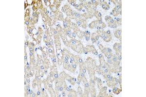 Immunohistochemistry of paraffin-embedded human liver injury using COX5B antibody (ABIN5974711) at dilution of 1/100 (40x lens). (COX5B 抗体)