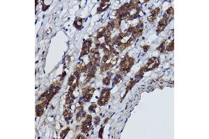 Immunohistochemistry of paraffin-embedded Rat heart using α-Smooth Muscle Actin  Rabbit pAb (ABIN6127402, ABIN6136473, ABIN6136476 and ABIN6214239) at dilution of 1:25 (40x lens). (Smooth Muscle Actin 抗体  (AA 1-124))