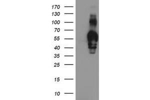 Western Blotting (WB) image for anti-Golgi Membrane Protein 1 (GOLM1) antibody (ABIN1498496)