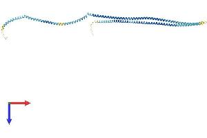 TCHP Protein (AA 1-498) (His tag)