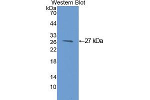 Western blot analysis of the recombinant protein. (GSTM1 抗体  (AA 1-218))
