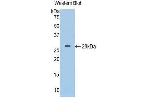 Western Blotting (WB) image for anti-alpha-1-B Glycoprotein (A1BG) (AA 313-513) antibody (ABIN1857839) (A1BG 抗体  (AA 313-513))