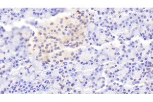 Detection of IL1RA in Human Pancreas Tissue using Polyclonal Antibody to Interleukin 1 Receptor Antagonist (IL1RA) (IL1RN 抗体  (AA 26-177))