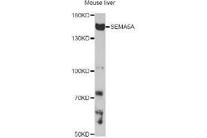 Western blot analysis of extracts of mouse liver, using SEMA5A antibody. (SEMA5A 抗体)