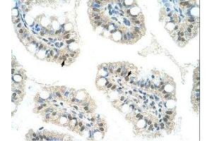 Image no. 1 for anti-Lysine (K)-Specific Demethylase 4D (KDM4D) (C-Term) antibody (ABIN6736292) (JMJD2D 抗体  (C-Term))