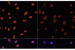 Immunofluorescence analysis of NIH/3T3 cells using Acetyl-Histone H4-K12 Polyclonal Antibody at dilution of 1:100.