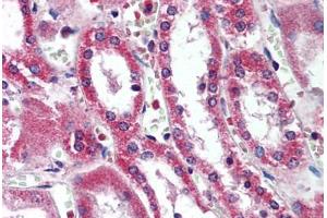 Human Kidney (formalin-fixed, paraffin-embedded) stained with SIRT5 antibody ABIN290374 at 5 ug/ml followed by biotinylated goat anti-rabbit IgG secondary antibody ABIN481713, alkaline phosphatase-streptavidin and chromogen. (SIRT5 抗体  (AA 30-46))