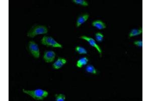 Immunofluorescent analysis of A549 cells using ABIN7170048 at dilution of 1:100 and Alexa Fluor 488-congugated AffiniPure Goat Anti-Rabbit IgG(H+L) (NKAIN4 抗体  (AA 83-150))