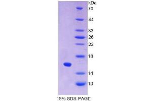 SDS-PAGE analysis of Cow IFNa Protein. (IFNA 蛋白)