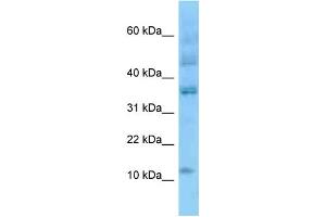 WB Suggested Anti-ID3 Antibody Titration: 1. (ID3 抗体  (N-Term))