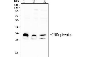 Western blot analysis of FHL using anti-FHL antibody (ABIN7600488).