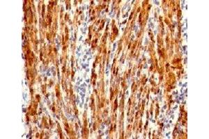 Formalin-fixed, paraffin-embedded human uterus stained with Calponin antibody (RMCN1-1). (Recombinant Calponin 抗体)