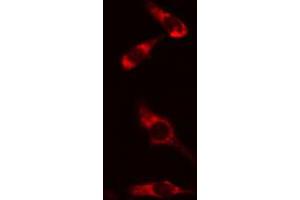 ABIN6274166 staining HeLa cells by IF/ICC. (HARS1/Jo-1 抗体  (C-Term))