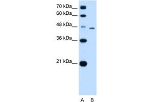 Western Blotting (WB) image for anti-TAP Binding Protein (Tapasin) (TAPBP) antibody (ABIN2462853) (TAPBP 抗体)
