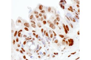 Immunohistochemistry (IHC) image for anti-Sjogren Syndrome Antigen B (SSB) (AA 358-408) antibody (ABIN7453946)