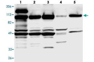 Western blot analysis of Lane 1: RT-4, Lane 2: U-251 MG, Lane 3: A-431, Lane 4: Liver, Lane 5: Tonsil with SMEK1 polyclonal antibody . (SMEK1 抗体)