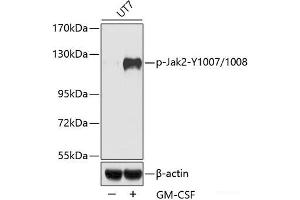 Western blot analysis of extracts of UT7 cells using Phospho-Jak2(Y1007/1008) Polyclonal Antibody. (JAK2 抗体  (pTyr1007, pTyr1008))