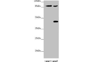 Western blot All lanes: SPICE1 antibody at 5. (SPICE1 抗体  (AA 1-220))