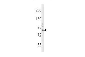 Western Blotting (WB) image for anti-Neurotrophic Tyrosine Kinase, Receptor, Type 1 (NTRK1) antibody (ABIN652382)