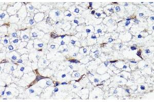 Immunohistochemistry of paraffin-embedded Human liver using CD44 Polyclonal Antibody at dilution of 1:100 (40x lens). (CD44 抗体)