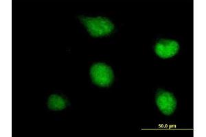 Immunofluorescence of purified MaxPab antibody to ZNF278 on HeLa cell. (PATZ1 抗体  (AA 1-537))