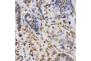 Immunohistochemistry (IHC) image for anti-Histone 3 (H3) (H3K36me3) antibody (ABIN3016039)