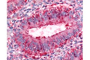 Anti-DPP8 antibody IHC of human uterus, endometrial glands. (DPP8 抗体  (Internal Region))